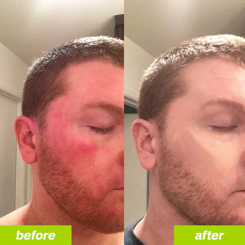 LiverLove® Milk Thistle Detox 2.0